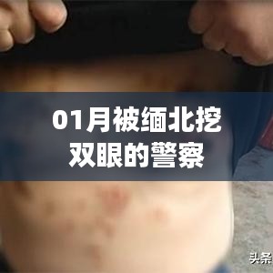緬北警察遭遇暴力襲擊，雙眼被挖事件回顧