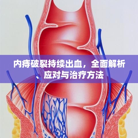 內(nèi)痔破裂持續(xù)出血，全面解析、應(yīng)對與治療方法