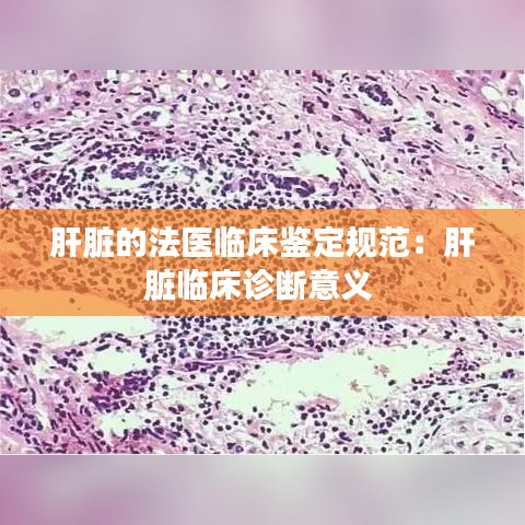 張弓拔弩 第3頁(yè)
