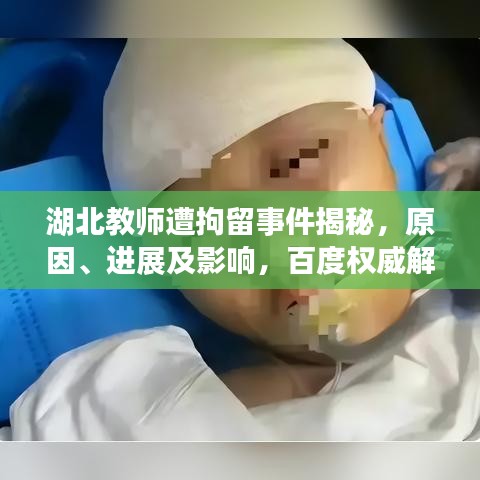 湖北教師遭拘留事件揭秘，原因、進(jìn)展及影響，百度權(quán)威解讀！