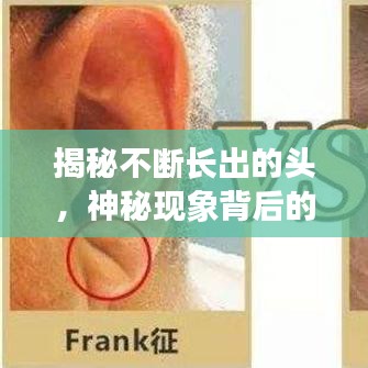 揭秘不斷長出的頭，神秘現(xiàn)象背后的醫(yī)學探索之旅