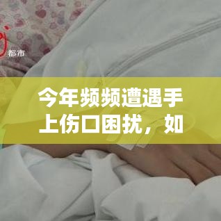 今年頻頻遭遇手上傷口困擾，如何應(yīng)對(duì)挑戰(zhàn)？