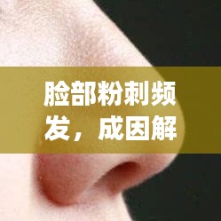 臉部粉刺頻發(fā)，成因解析與防治管理策略