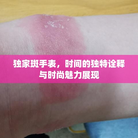 獨家斑手表，時間的獨特詮釋與時尚魅力展現(xiàn)